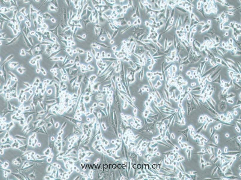 NCI-H1993细胞 (人非小细胞肺癌腺癌细胞) (STR鉴定正确)CL-0923