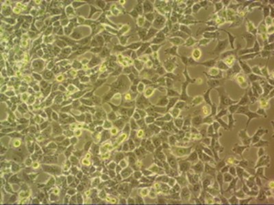 HEM-L人表皮黑色素细胞