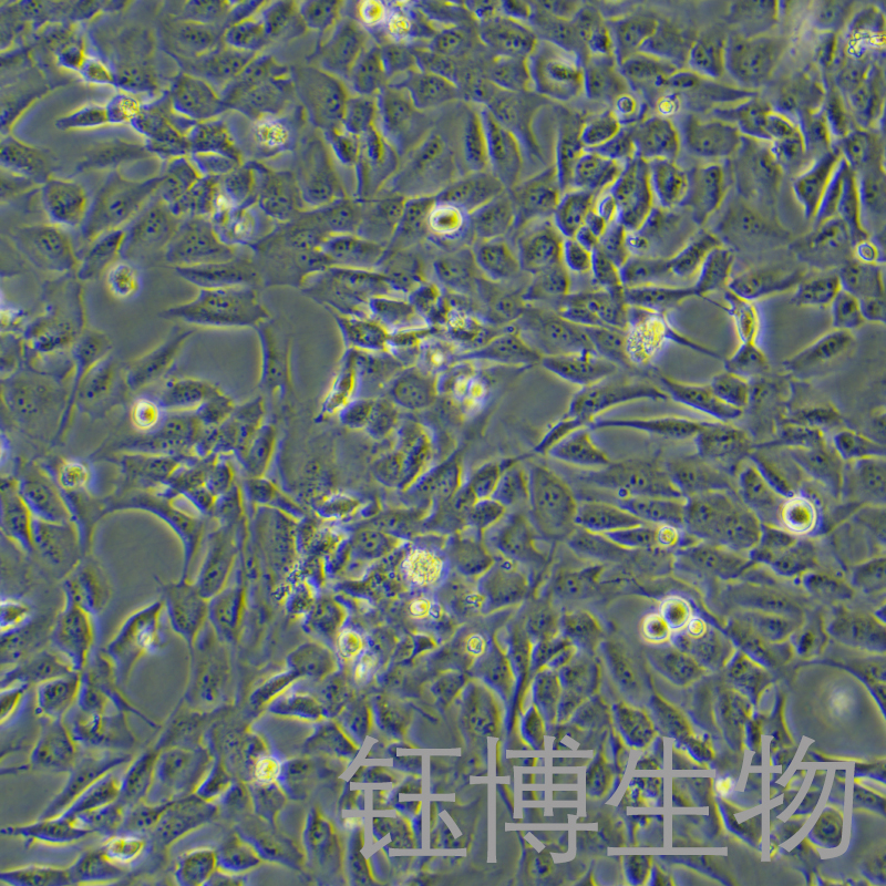 WPMY-1（人正常前列腺基质永生化细胞）YB-71467HC