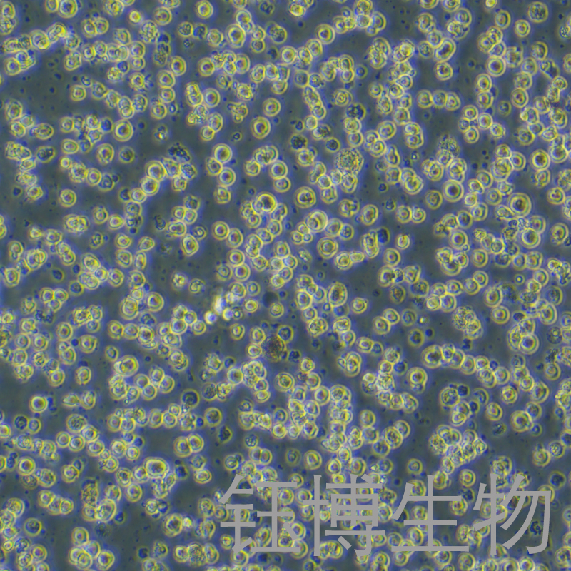 MEG-01（人成巨核细胞白血病细胞）YB-71498HC