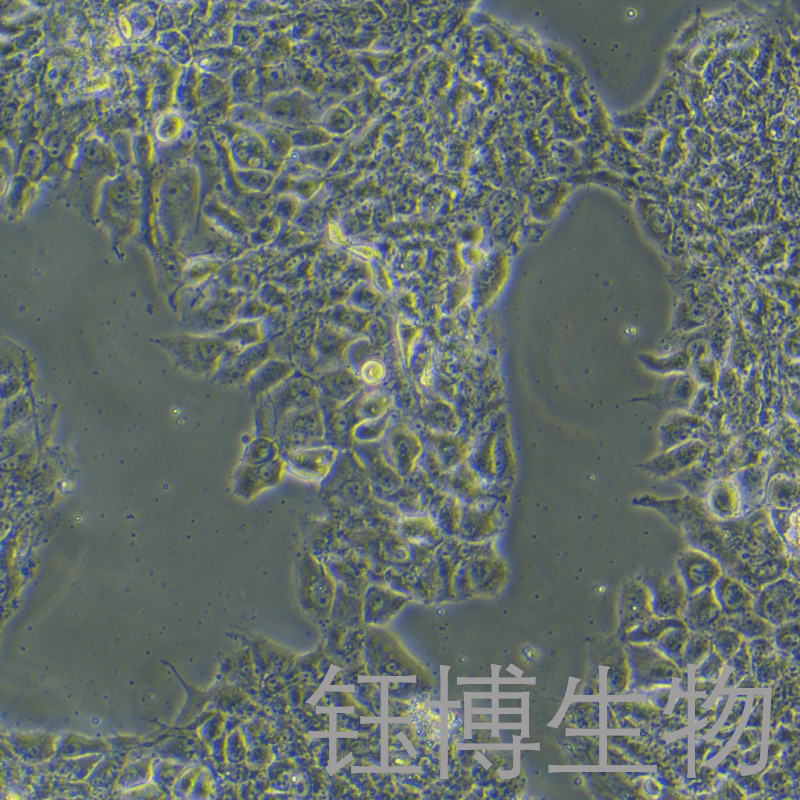 Bewo（人绒毛膜肿瘤细胞）YB-71500HC