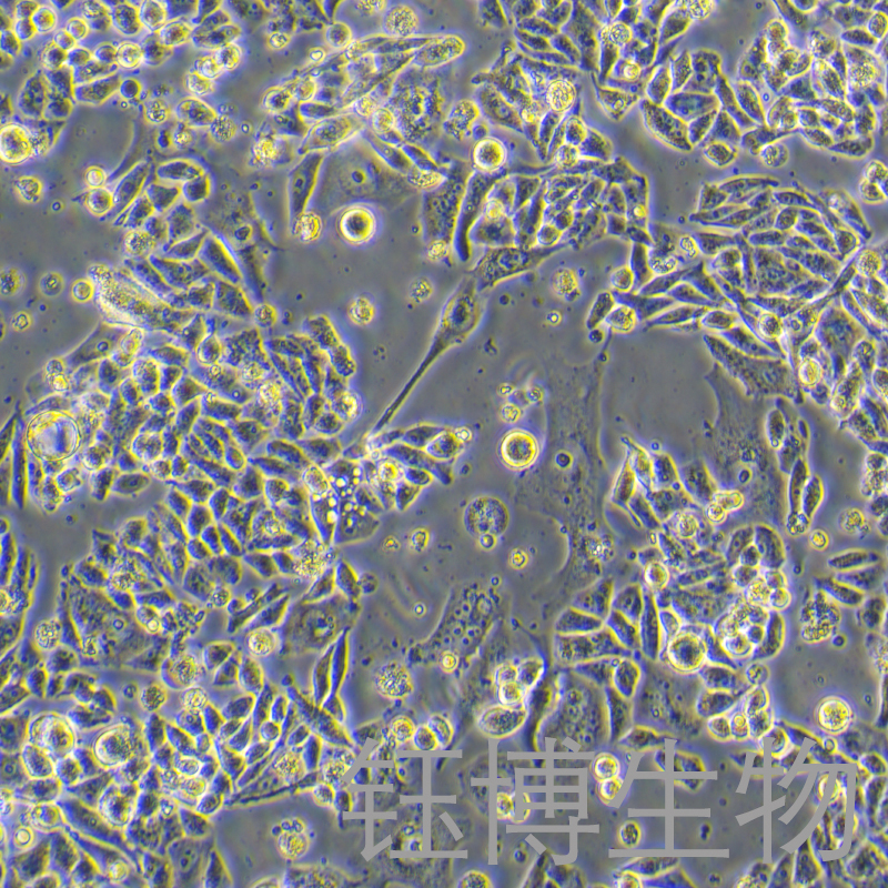 AN3 CA（人子宫内膜腺癌细胞）YB-71505HC