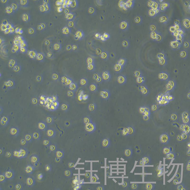 NCI-H929（人骨髓瘤细胞）YB-71509HC