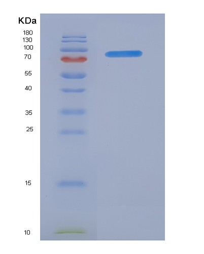 Recombinant Human FAP / Seprase Protein (His tag)