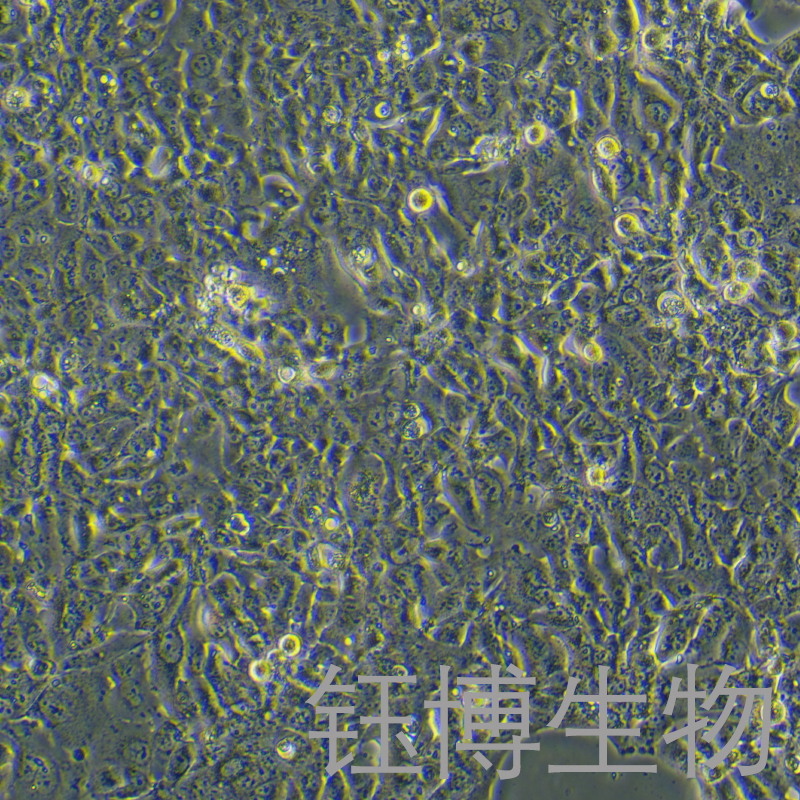 NCI-H441（人肺腺癌细胞）YB-71514HC