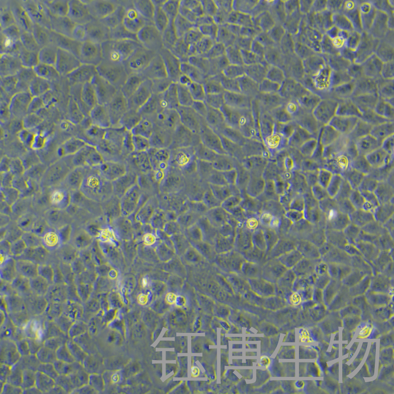 SK-OV-3/DDP（人卵巢腺癌顺铂耐药性细胞）YB-71524HC