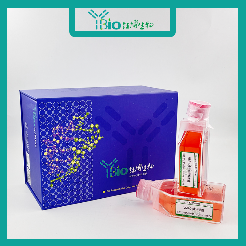 SGC-7901-GFP（人胃腺癌细胞（绿色荧光））YB-71526HC