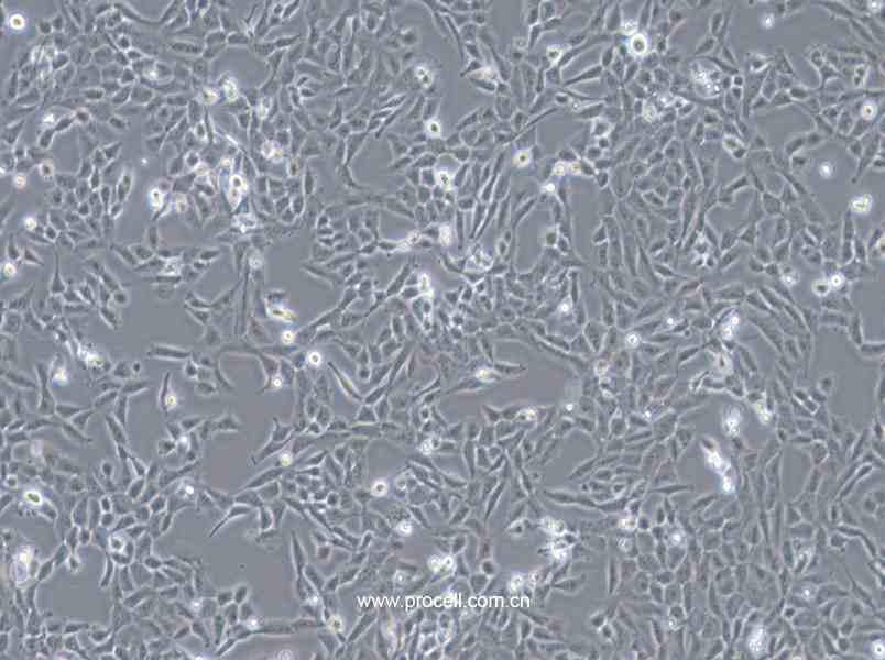 F81细胞 (猫肾细胞) (种属鉴定正确)CL-0081