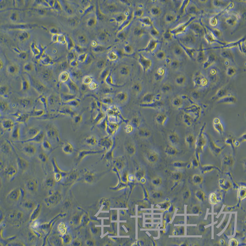 LX-2（人肝星形细胞）YB-71560HC