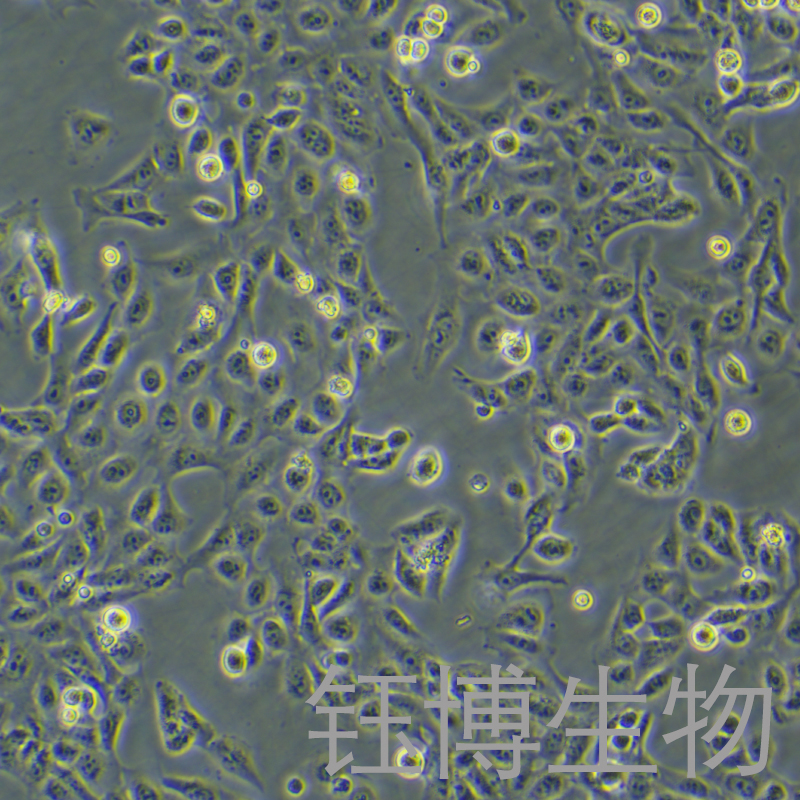 GES-1（人胃粘膜细胞）YB-71563HC