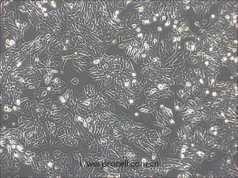 Y1 细胞[Y-1细胞] (小鼠肾上腺皮质瘤细胞) (种属鉴定正确)CL-0245
