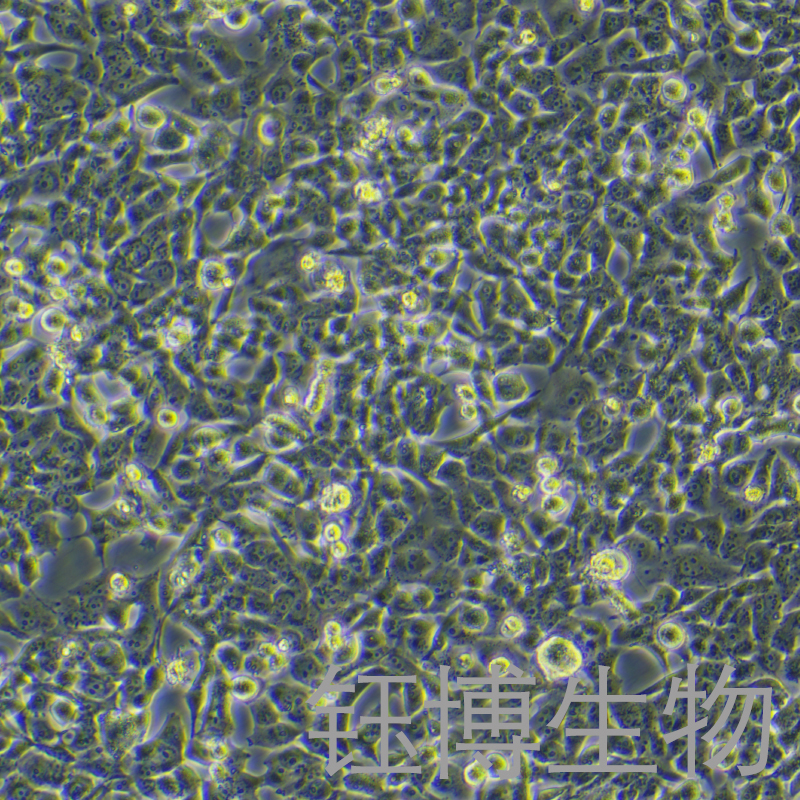 95-D [PLA-801D]（人高转移肺癌细胞）YB-71011HC