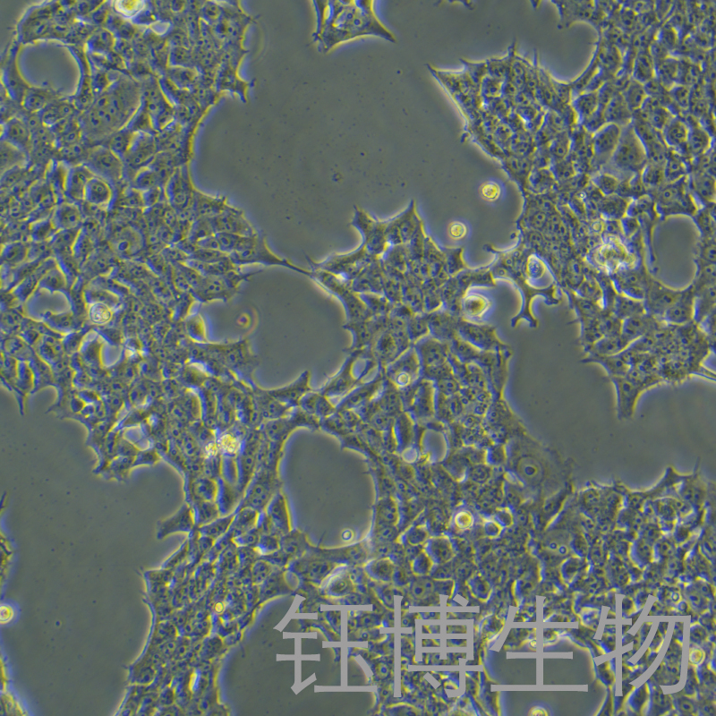 293 [HEK-293]（人胚肾细胞）YB-71001HC