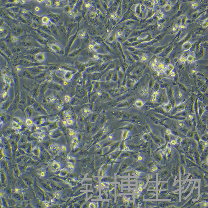 786-O [786-0]（人肾透明细胞腺癌细胞）YB-71010HC