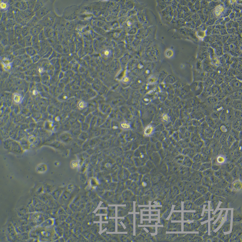 A-431（人表皮癌细胞）YB-71015HC