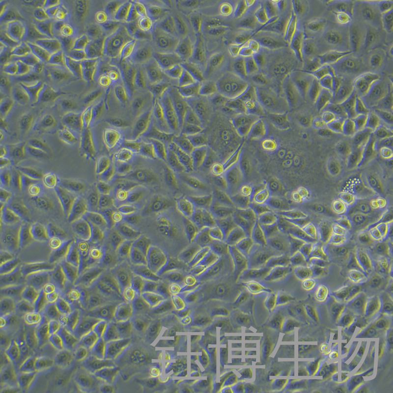 A549 [A-549]（人非小细胞肺癌细胞）YB-71016HC