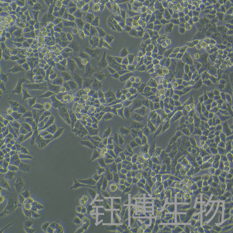 A2780（人卵巢癌细胞）YB-71013HC