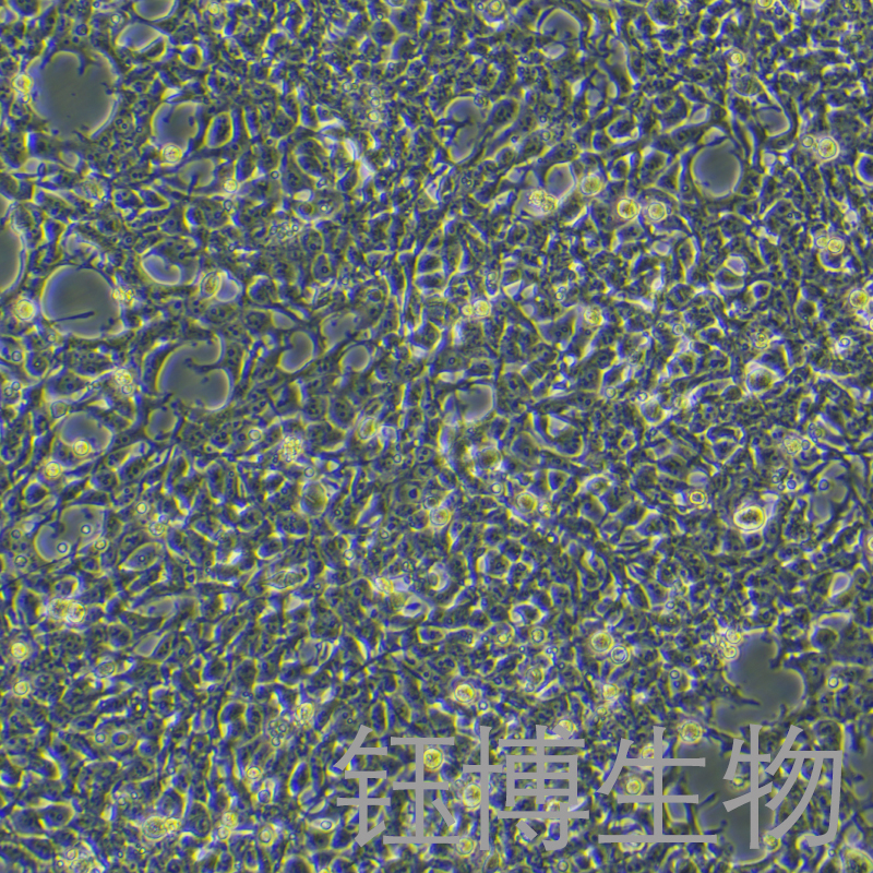 AAV-293（人胚肾细胞）YB-71019HC