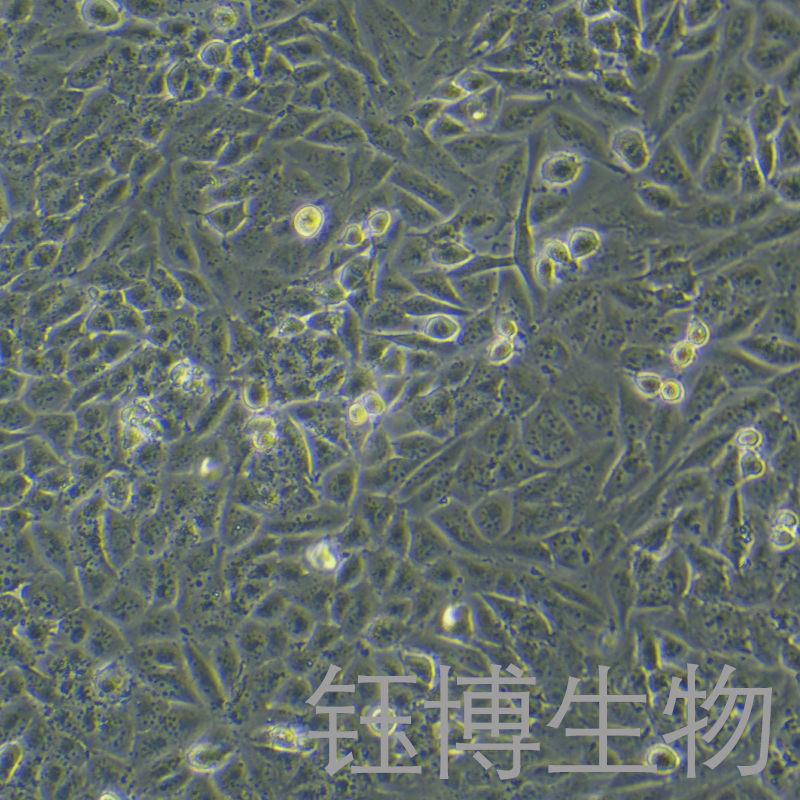 T98G（人脑胶质瘤细胞）YB-71583HC