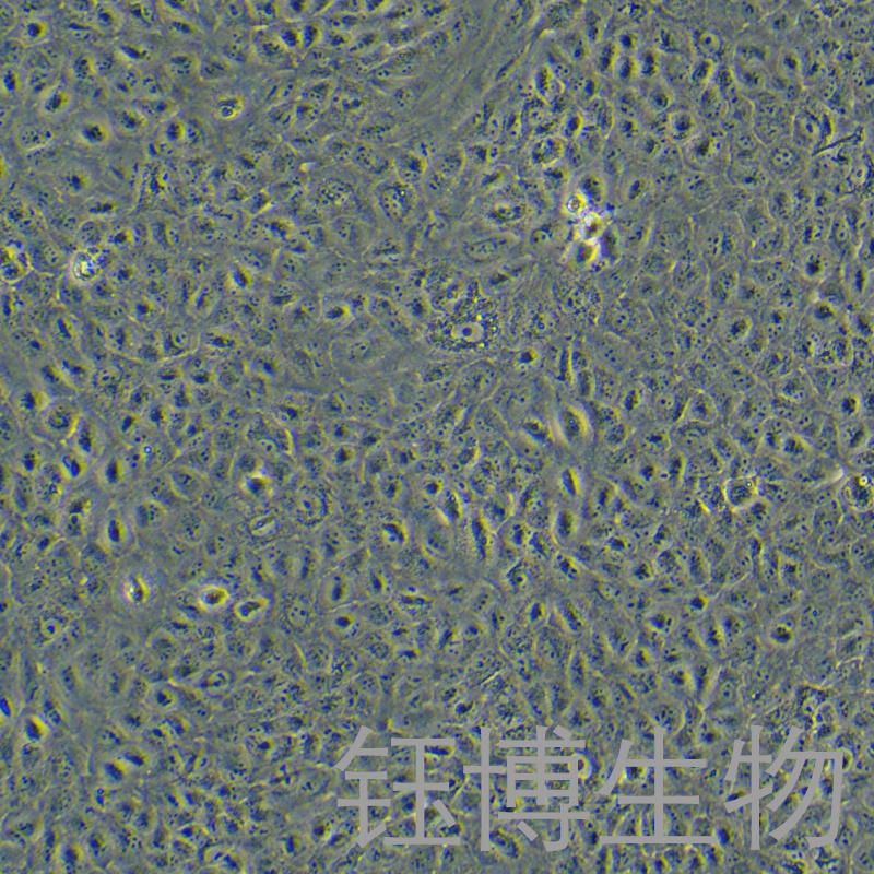 A549/Tax（人肺腺癌紫杉醇耐药性细胞）YB-71585HC