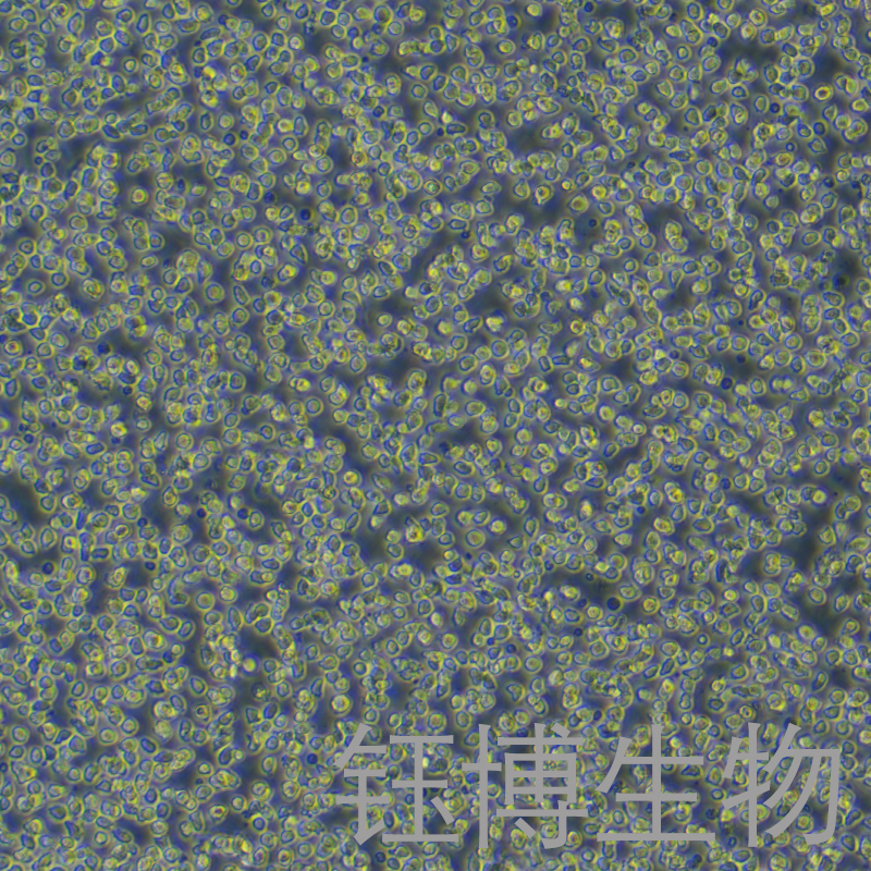 HAL-01（人淋巴细胞白血病细胞）YB-71588HC