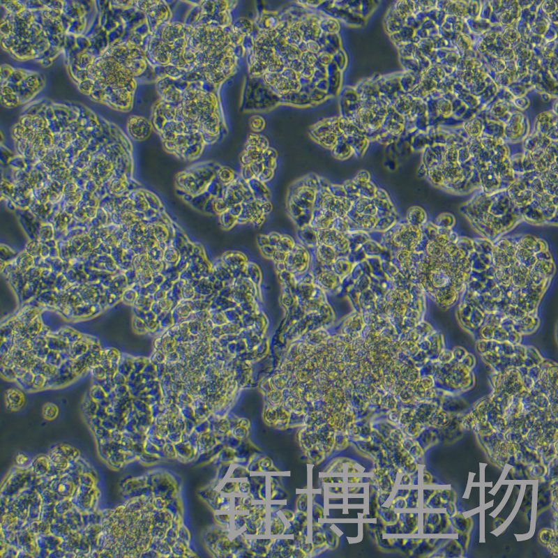 Hep-G2/2.2.15（人肝癌细胞）YB-71594HC