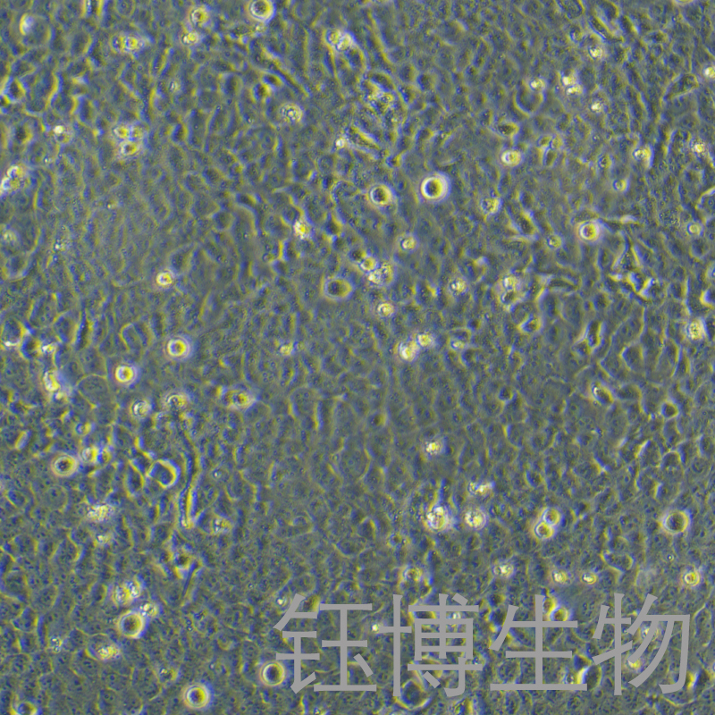 HTR-8/Svneo（人绒毛膜滋养层细胞）YB-71599HC