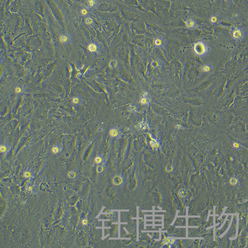 SNU-387（人肝癌细胞）YB-71612HC