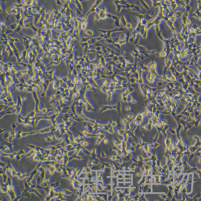 BE (2)-M17（人神经母细胞瘤细胞）YB-71262HC