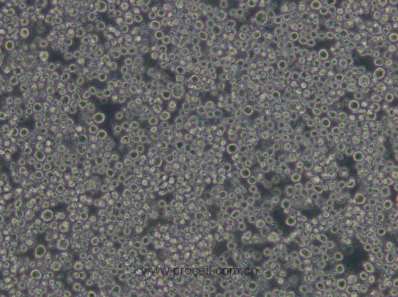 P3X63Ag8.653细胞 (小鼠骨髓瘤细胞) (STR鉴定正确)CL-0410