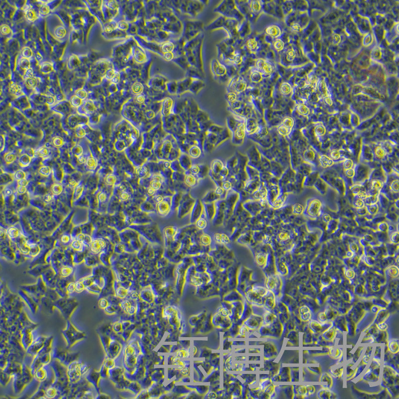 BIU-87（人膀胱癌细胞）YB-71035HC