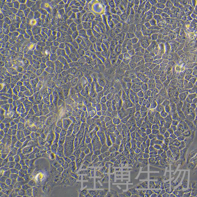 BxPC-3（人原位胰腺腺癌细胞）YB-71042HC