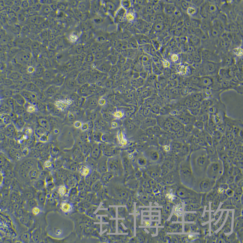 HT-3（人子宫颈癌细胞）YB-71630HC