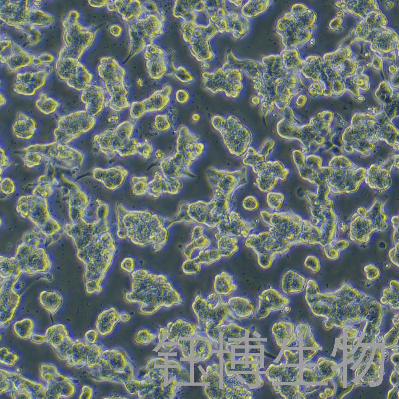 SNU-719（人胃癌细胞）YB-71633HC