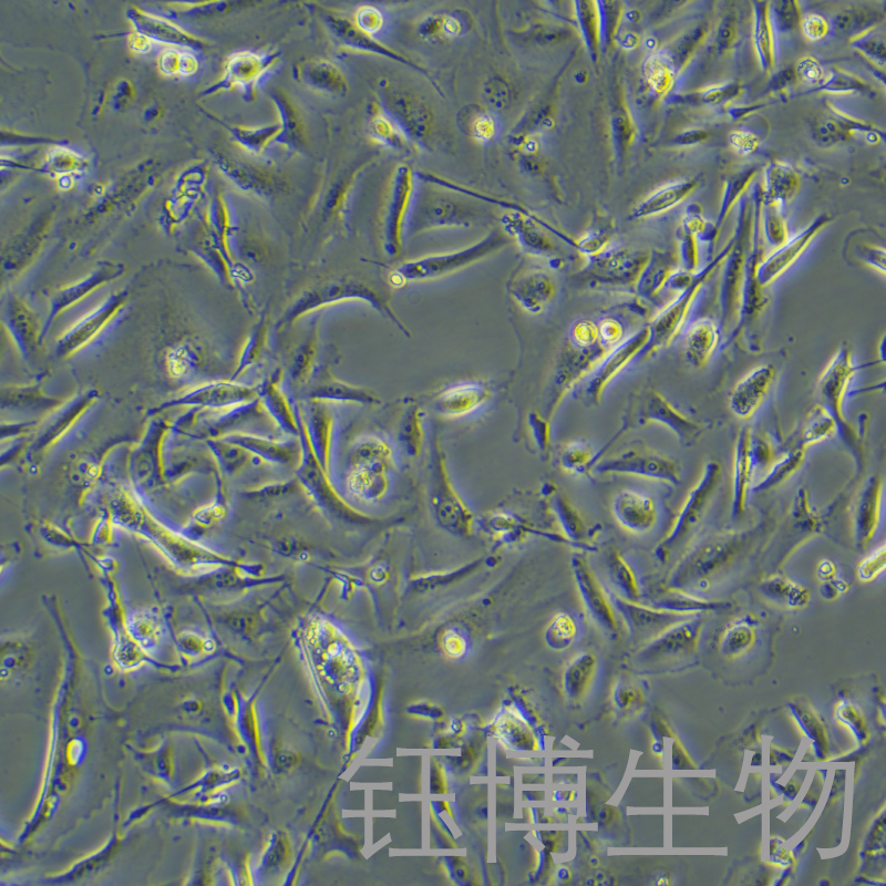 MDA-MB-231/GFP（人乳腺癌细胞（绿色荧光蛋白标记））YB-71642HC