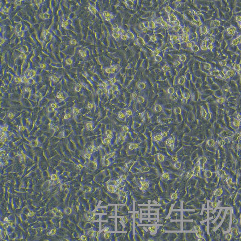 CAL-62（人甲状腺癌细胞（未分化））YB-71618HC