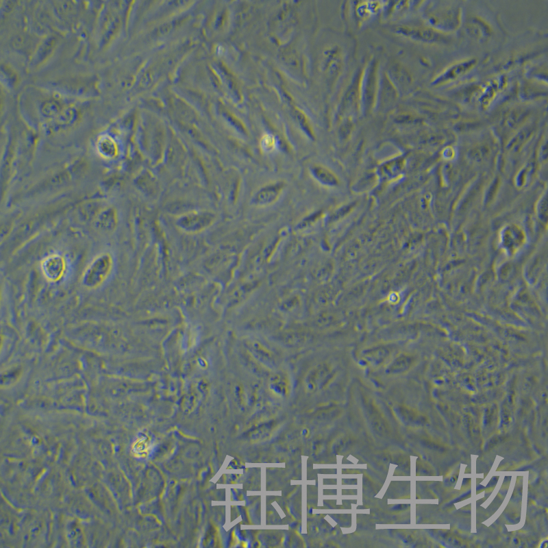 TCCSUP（人膀胱癌细胞）YB-71628HC
