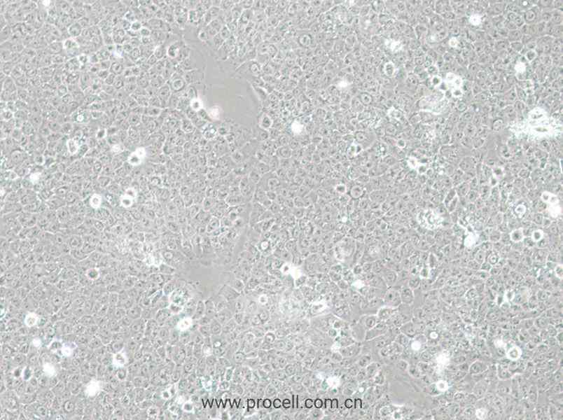 TE-12细胞 (人食管癌细胞) (STR鉴定正确)CL-0751