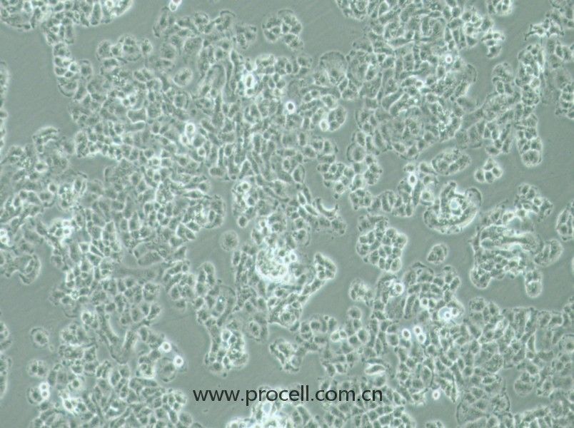 QGP-1细胞 (人胰腺癌细胞) (STR鉴定正确)CL-0977