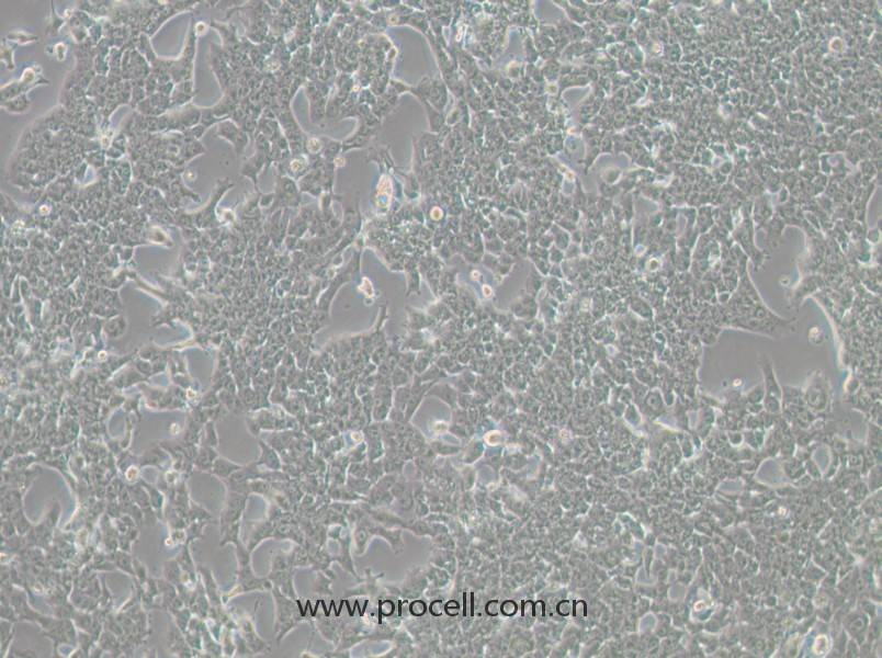 HePa1-6-LUC细胞 (小鼠肝癌细胞（荧光素酶标记）) (STR鉴定正确)CL-1007