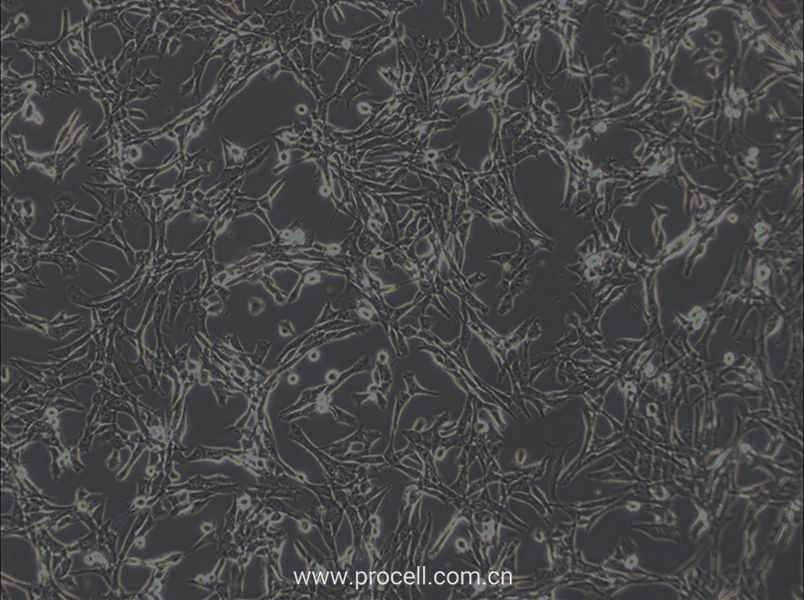 3T6-Swiss albino细胞 (小鼠胚胎成纤维细胞) (STR鉴定正确)CL-0285