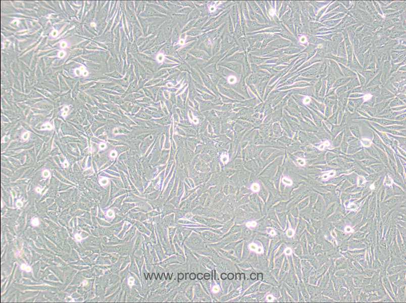 A2058细胞 (人皮肤癌细胞) (STR鉴定正确)CL-0652