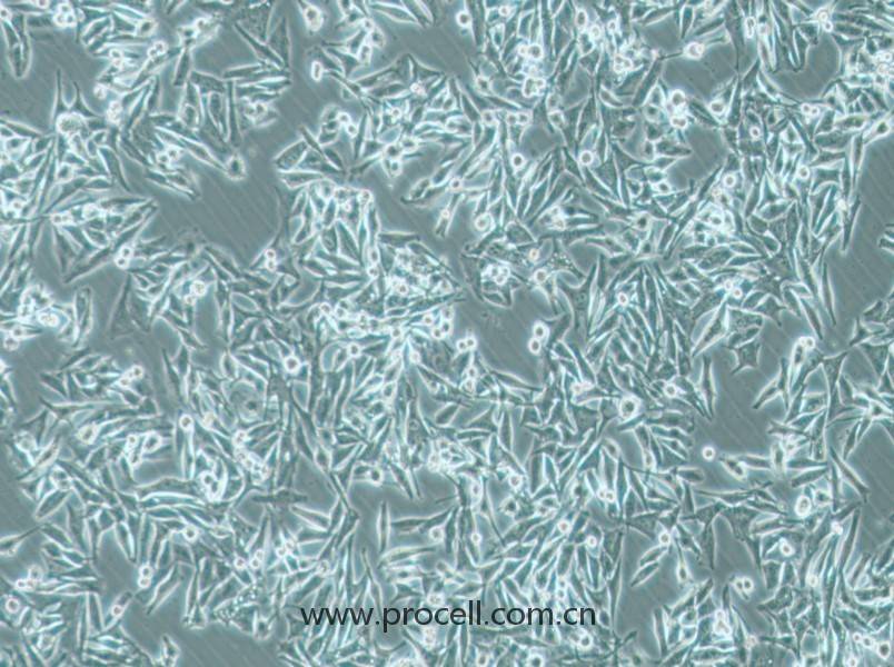 SK-MEL-5细胞 (人皮肤黑色素瘤细胞) (STR鉴定正确)CL-0707
