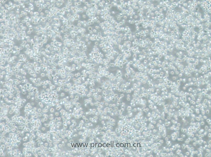 TK6细胞 (人成淋巴细胞) (STR鉴定正确)CL-0813