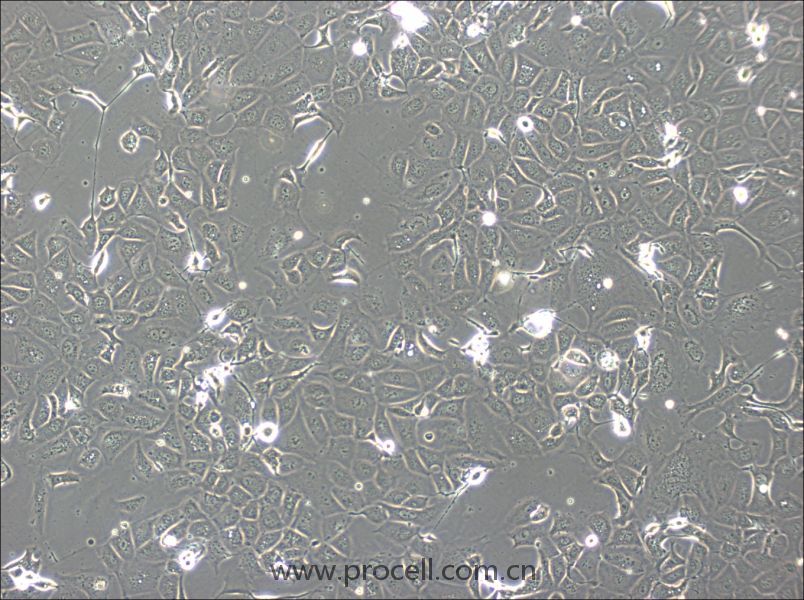 NCI-H1693细胞 (人肺腺癌细胞) (STR鉴定正确)CL-0876