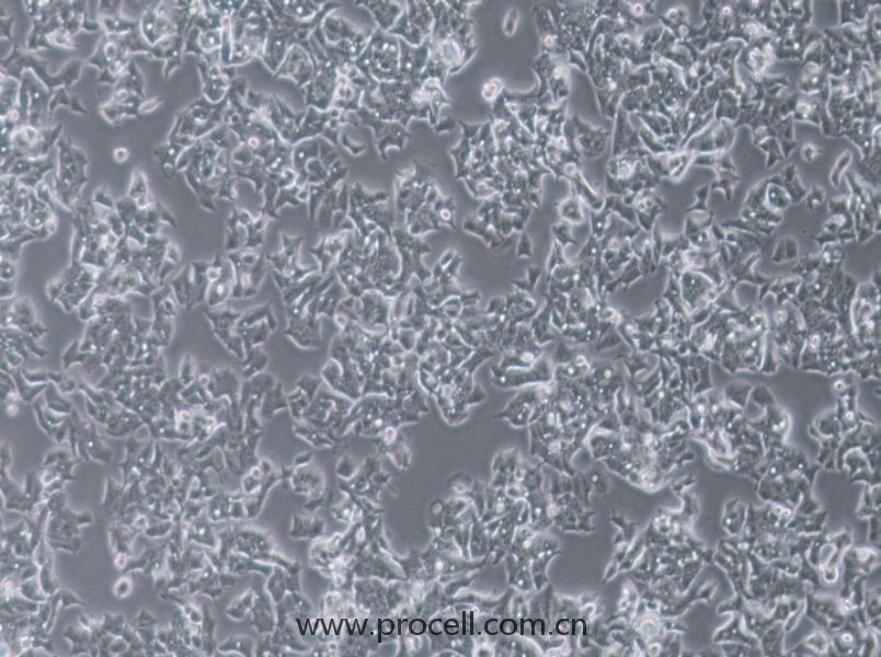 LS180细胞 (人结肠癌细胞) (STR鉴定正确)CL-0888