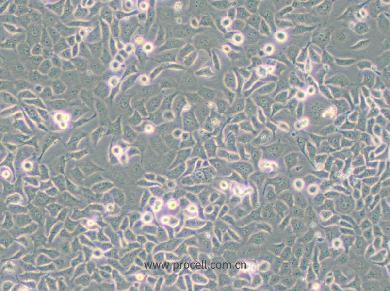SHZ-88细胞 (大鼠乳腺癌细胞) (种属鉴定正确)CL-0209
