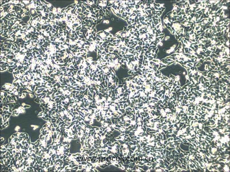 SK-CO-1细胞 (人结直肠腺癌细胞) (STR鉴定正确）CL-0439