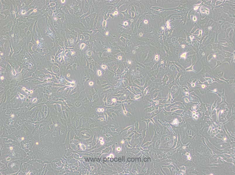 NCI-H1568 细胞[H1568细胞] (人非小细胞肺癌细胞) (STR鉴定正确)CL-0690