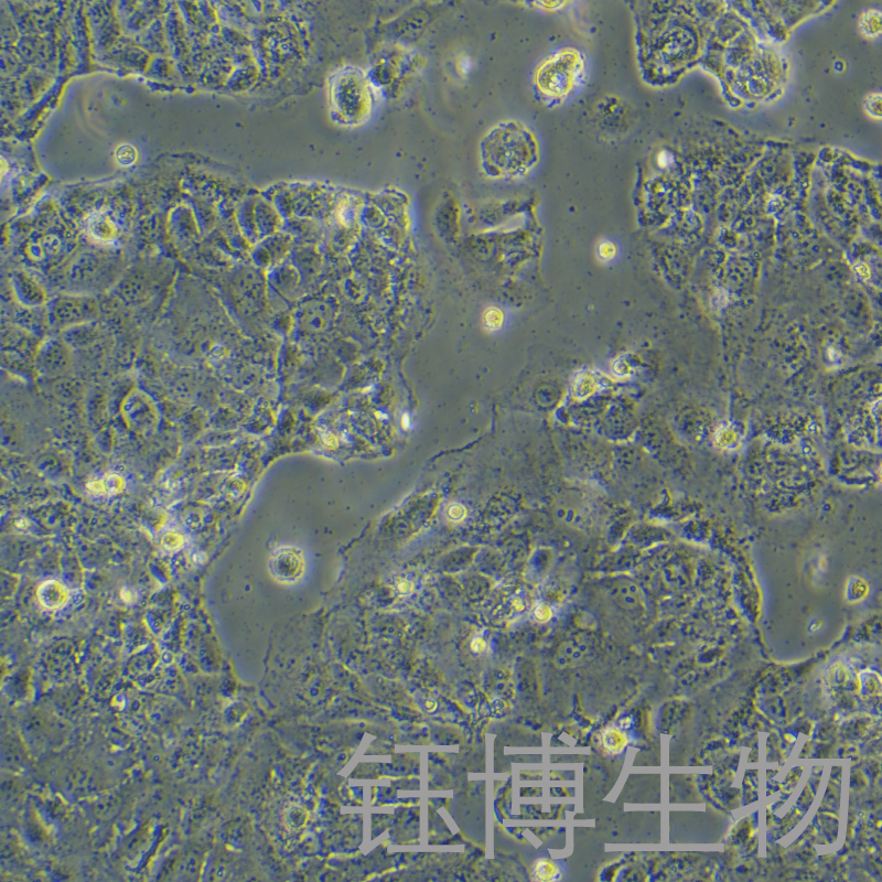 Caco-2（人结直肠腺癌细胞）YB-71050HC